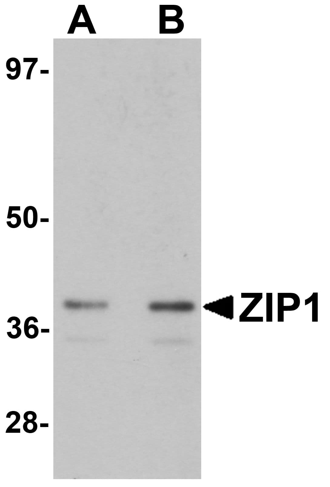 Polyclonal Rabbit anti-Human SLC39A1 Antibody (IHC, IF, WB)