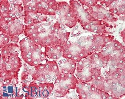 IHC-plus™ Polyclonal Rabbit anti-Human PDIA6 / ERP5 Antibody (IHC, IF, WB)