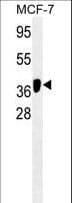 IHC-plus™ APG4B / ATG4B Antibody