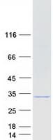 Human SNF8 / EAP30 Protein (Recombinant Myc-DDK (Flag))