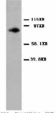 PRKCA / PKC-Alpha Antibody (C-Terminus)