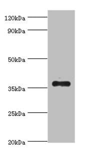 AKR1B10 Antibody (aa1-316)