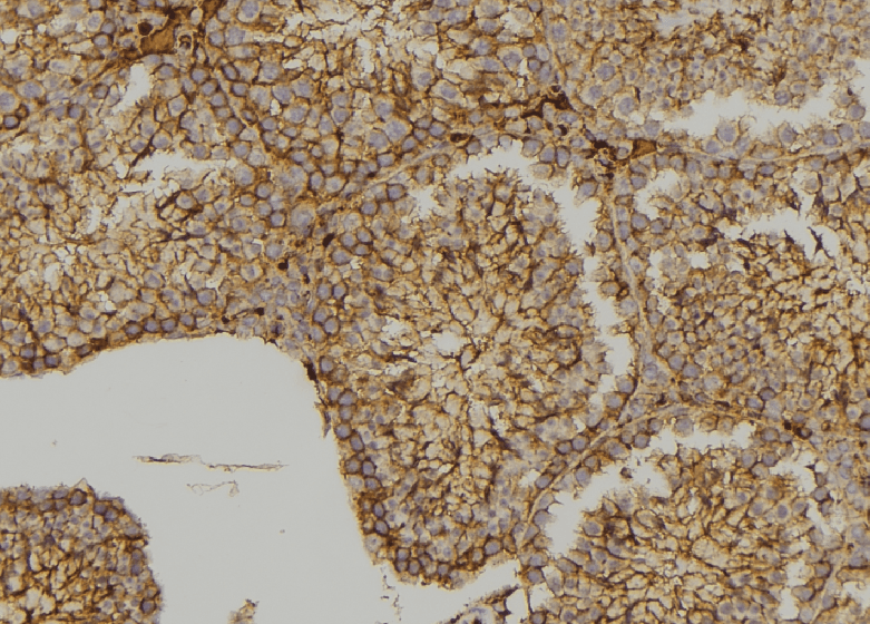 MYO3B Antibody
