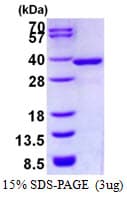 Human NMRAL1 / HSCARG Protein (Recombinant His)