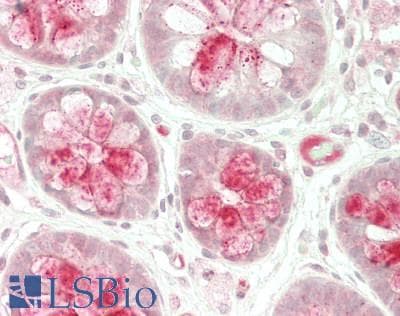 IHC-plus™ Polyclonal Rabbit anti-Human PPP1CB Antibody (IHC, IF, WB)