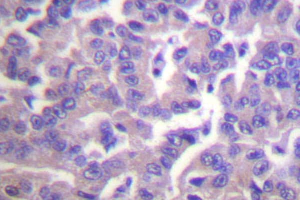CALD1 / Caldesmon Antibody (Ser783)