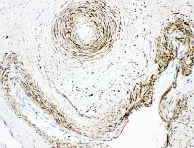 MAOA / Monoamine Oxidase Antibody (aa51-69)