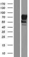 TACC1 Protein (Over-Expression Lysate Myc-DDK (Flag))