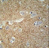 SNCB / Beta-Synuclein Antibody (aa93-122)