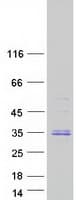 Human C9orf40 Protein (Recombinant Myc-DDK (Flag))