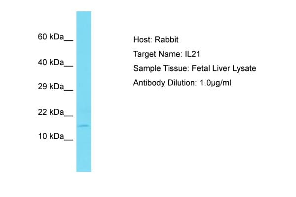 Polyclonal Rabbit anti-Human IL21 Antibody (C-Terminus, WB)