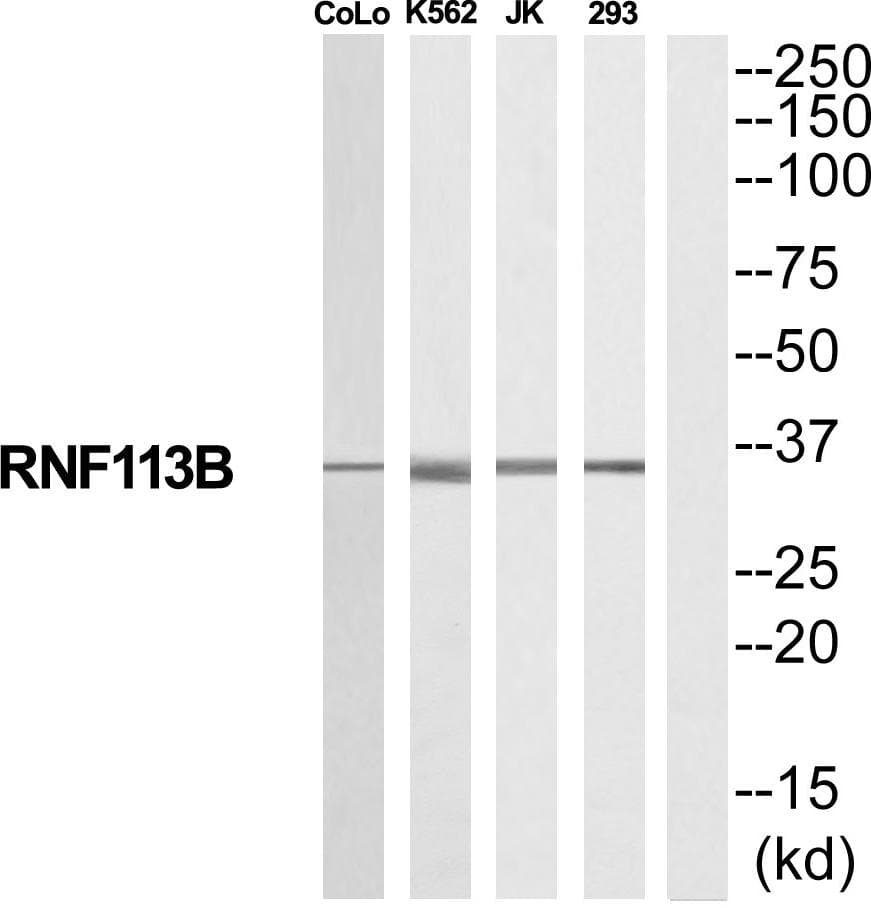 Polyclonal Rabbit anti-Human RNF113B Antibody (WB)