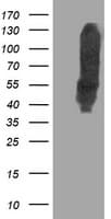 Monoclonal Mouse anti-Human DLD / Diaphorase / E3 Antibody (clone OTI4A10, IHC, IF, WB)