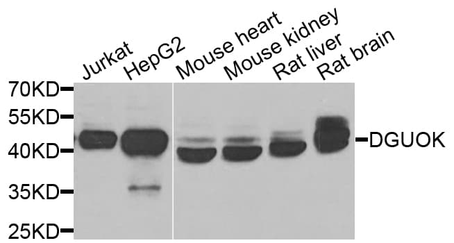 DGUOK / Deoxyguanosine Kinase Antibody