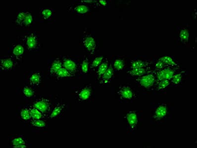 ACAD11 Antibody