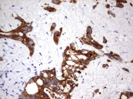 Acidic Cytokeratin Antibody (clone 8F5)