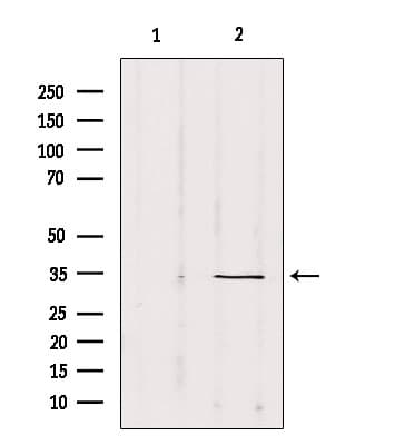 Polyclonal Rabbit anti-Human SOX12 Antibody (IF, WB)