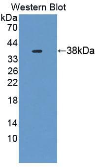 NAG20 / UBAP1 Antibody (aa1-295, PE)