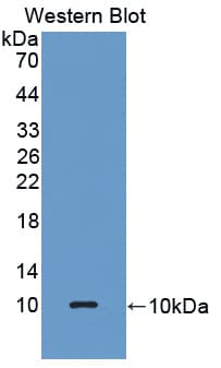 GPX3 Antibody (aa21-72)