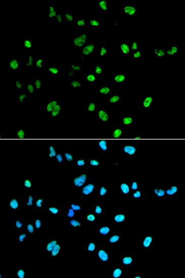 Polyclonal Rabbit anti-Human PAX2 Antibody (IF, WB)
