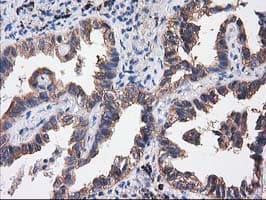 SULT1C2 / Sulfotransferase 1C2 Antibody (clone OTI4G1)