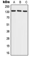 IHC-plus™ RECQL4 Antibody (C-Terminus)