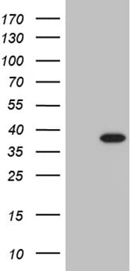 PHF20L1 Antibody (clone OTI1F4)