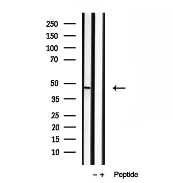 BBS5 Antibody