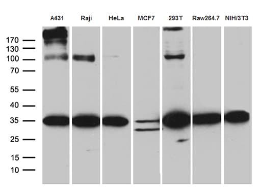 Monoclonal Mouse anti-Human RPL7A / Ribosomal Protein L7a Antibody (clone OTI4D5, aa2-266, IHC, WB)