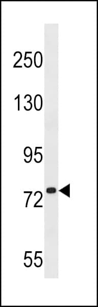 KIZ / PLK1S1 Antibody (aa57-86)