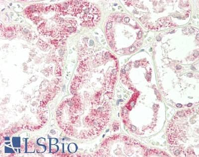 MAPK11 / SAPK2 / p38 Beta Antibody (aa20-69)