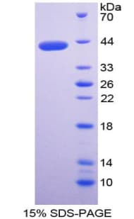 Pig MGP / Matrix Gla-Protein (Recombinant His-GST)