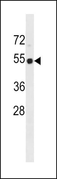 TP53 / p53 Antibody (aa187-215)
