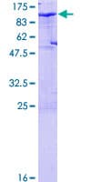 Human CDH6 / K Cadherin Protein (Recombinant GST)