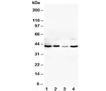 Polyclonal Rabbit anti-Human VEGFD Antibody (aa101-115, IHC, WB)