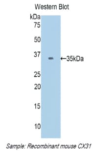 GJB3 / CX31 / Connexin 31 Antibody (aa213-270)