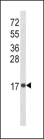 Polyclonal Rabbit anti-Human IL8 / Interleukin 8 Antibody (aa72-99, IHC, IF, WB)