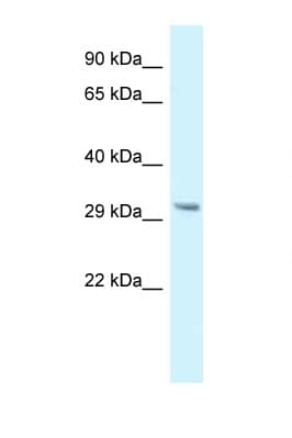 GNMT Antibody (N-Terminus)