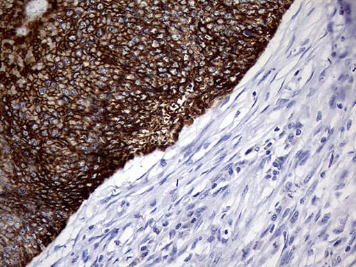 KRT8 / CK8 / Cytokeratin 8 Antibody (aa91-381, clone OTI2F5)
