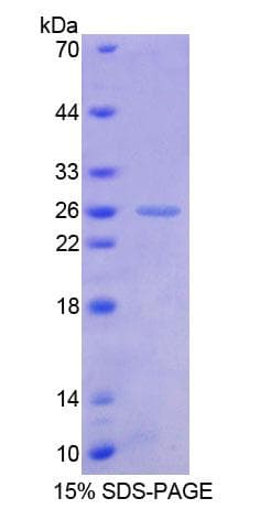 Human FLI1 Protein (Recombinant His-T7)