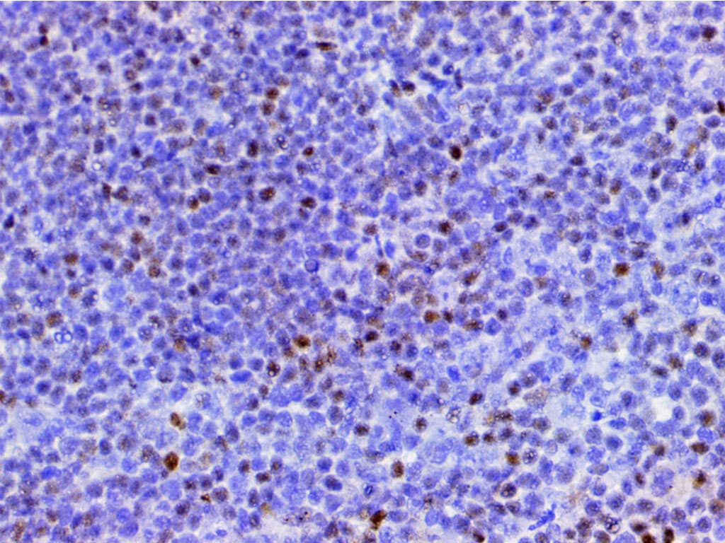 CFL1 / Cofilin Antibody (phospho-Ser3)