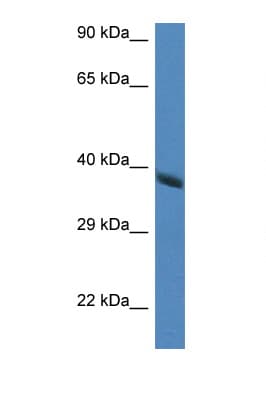 HAO2 Antibody (aa240-289)