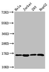 Polyclonal Rabbit anti-Human HIST1H3A Antibody (IHC, IF, WB)