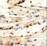Polyclonal Rabbit anti-Human C1orf42 / NICE-1 Antibody (aa1-30, IHC, WB)