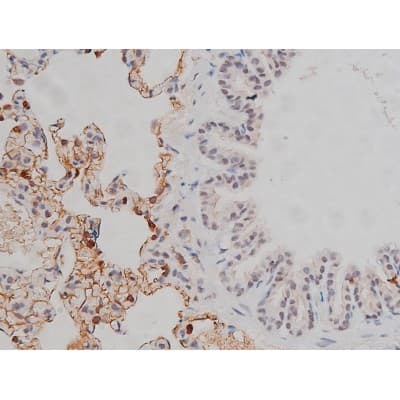 Polyclonal Rabbit anti-Human LYN Antibody (phospho-Tyr508, IHC, IF, WB)