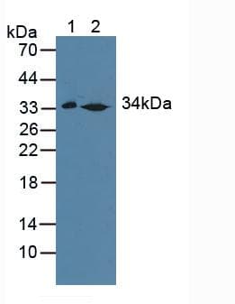 SULT1A1 / Sulfotransferase 1A1 Antibody (aa3-285, Biotin)