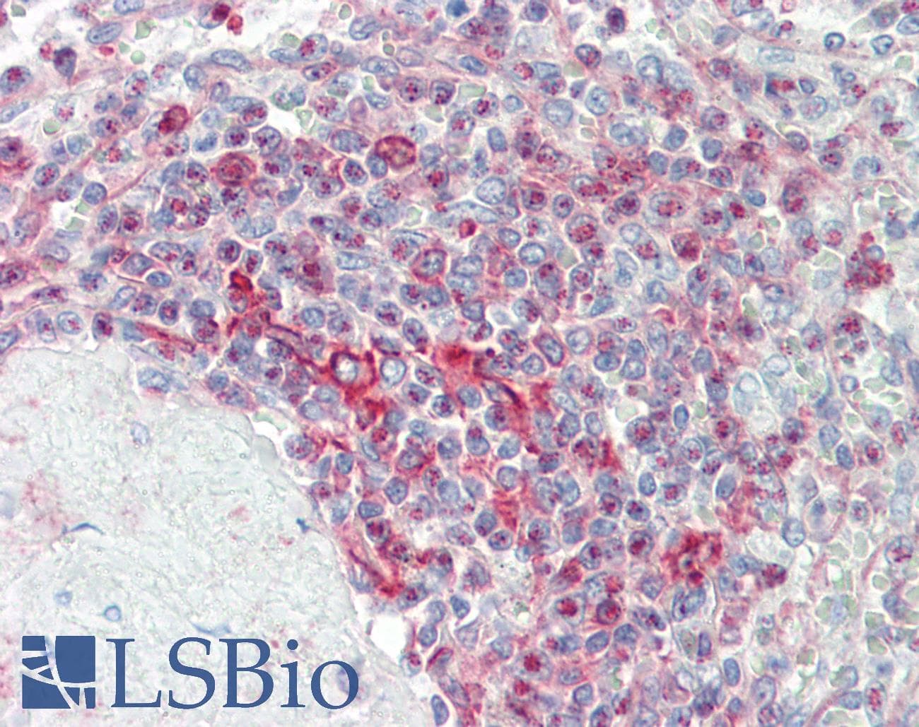 IHC-plus™ CLK4 Antibody (aa101-150)