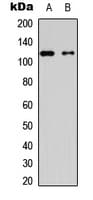 HK1 / Hexokinase 1 Antibody (N-Terminus)