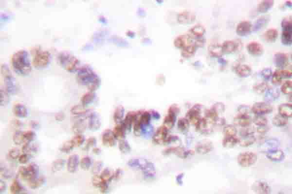 POLR2A / RNA polymerase II Antibody (phospho-Ser1619)