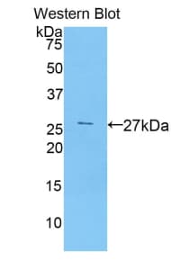 CBFA1 / RUNX2 Antibody (aa299-521)
